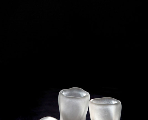 Abbildung von Jan Schindler. Teeth. 2024